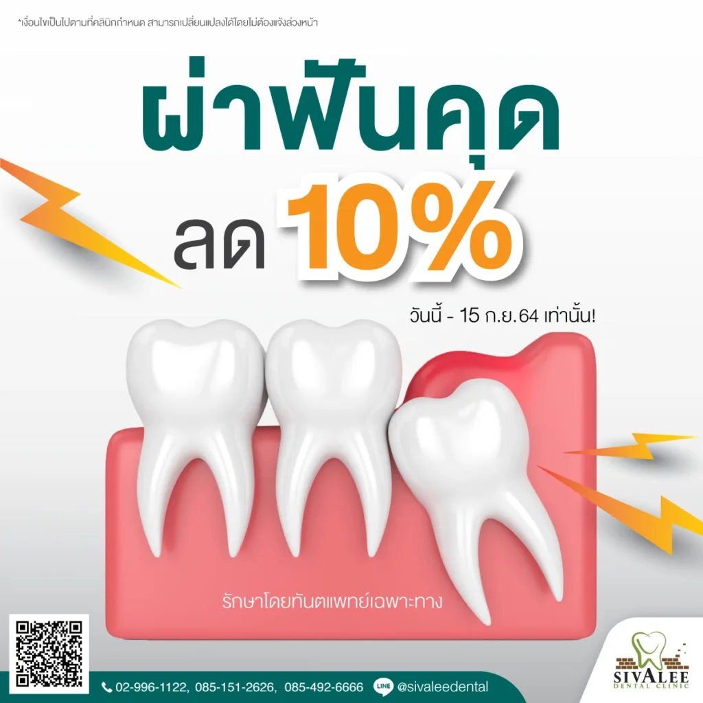 โปรโมชั่น ผ่าฟันคุด