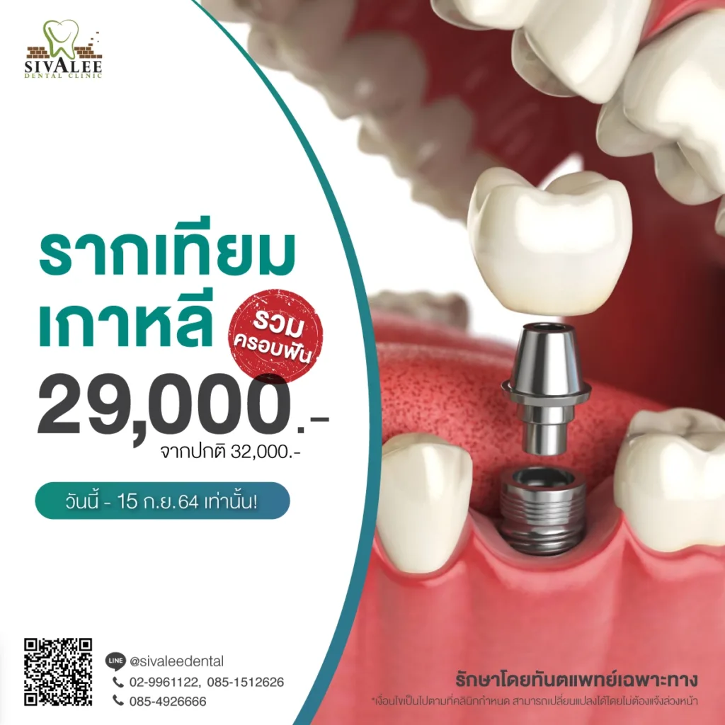 โปรโมชั่น รากเทียมเกาหลี