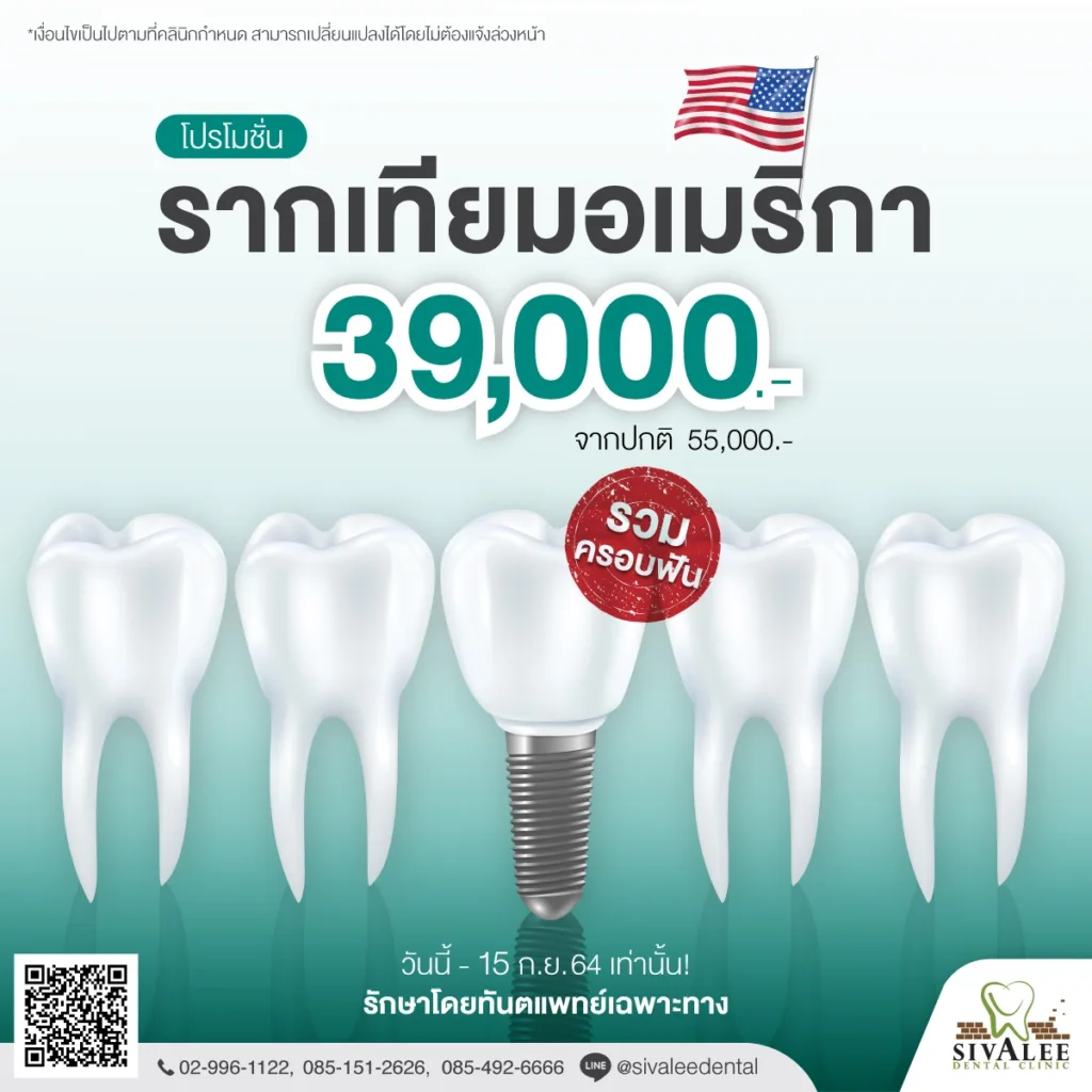 โปรโมชั่น รากเทียมอเมริกา